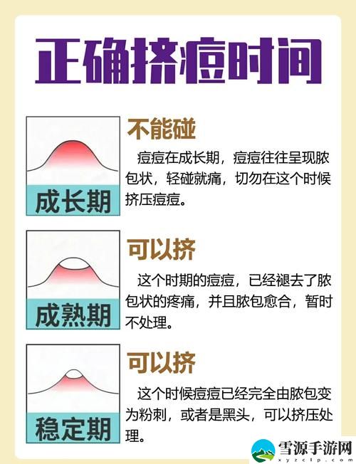 怎样弄小痘痘才会浑身酥软火爆上线，平台：青春无限