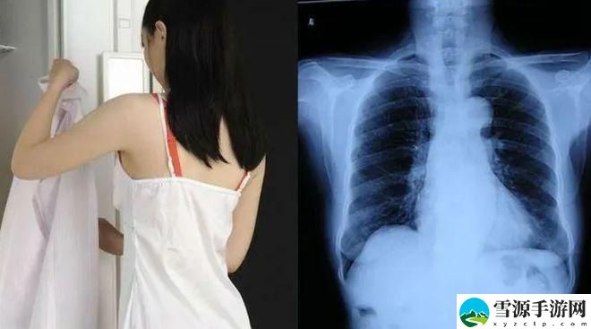 100%胸片曝光率图片女生，网友直言：这份勇气令人敬佩！
